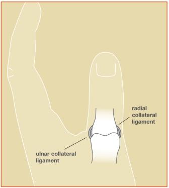 Thumb Sprain Image 1