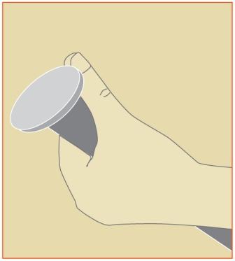 Thumb Sprain Image 2